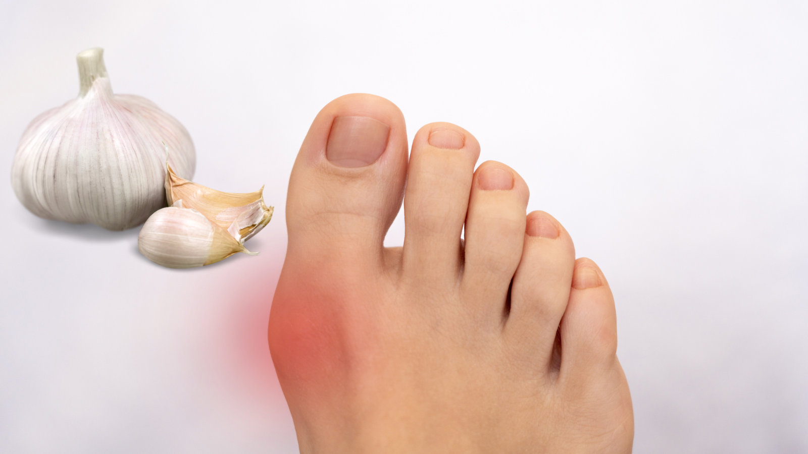 Người bệnh gút nên dùng tỏi vừa phải và tuân thủ chỉ định của bác sĩ