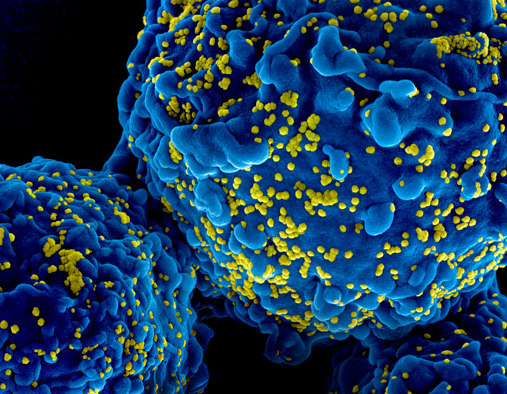 Bệnh HIV từ đâu ra? Biện pháp phòng ngừa bệnh HIV hiệu quả 1