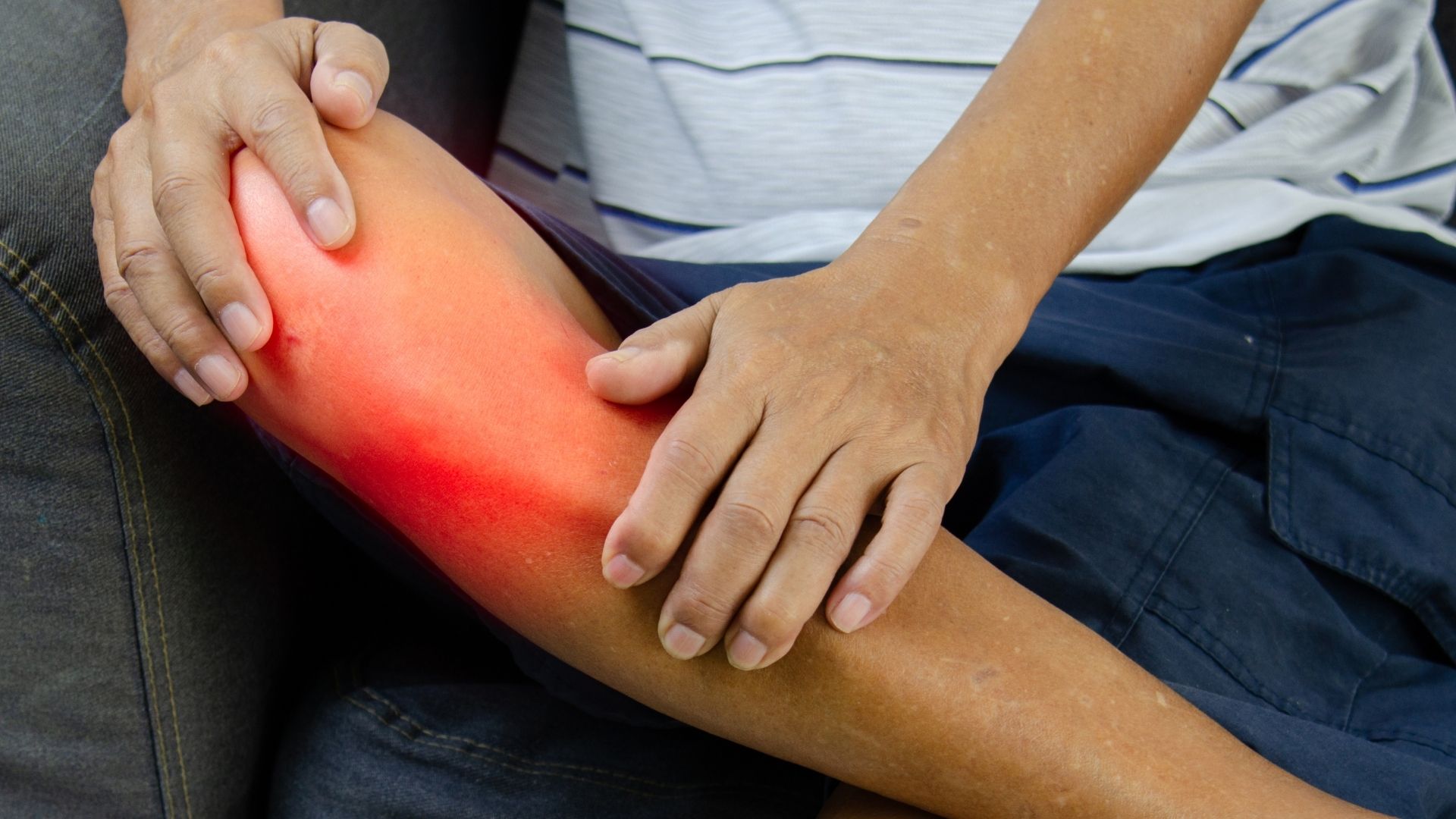 Người mắc bệnh Leptospira có thể sốt cao kèm đau cơ toàn thân