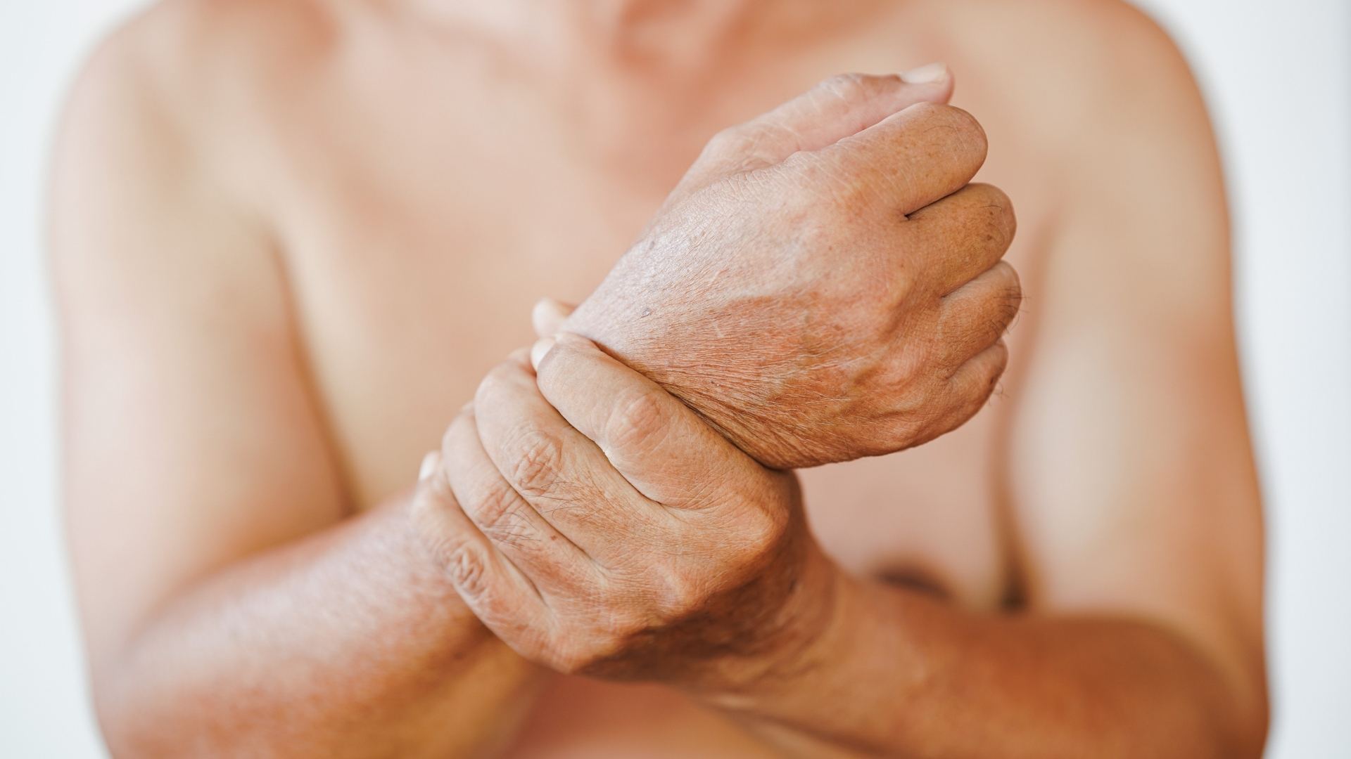Bệnh lupus ban đỏ giai đoạn đầu: Dấu hiệu, chẩn đoán và điều trị 3