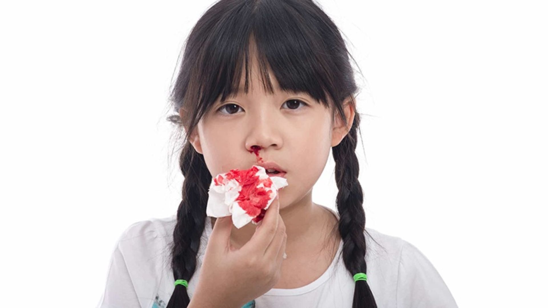 Chảy máu khó cầm thường xuyên có thể là dấu hiệu cảnh báo bệnh máu khó đông