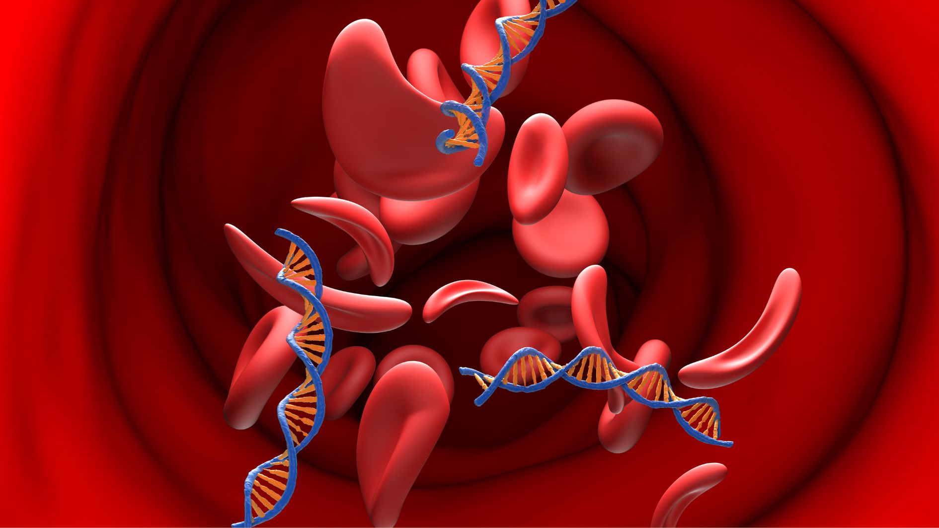 Bệnh mỡ máu cao có chữa khỏi được không?