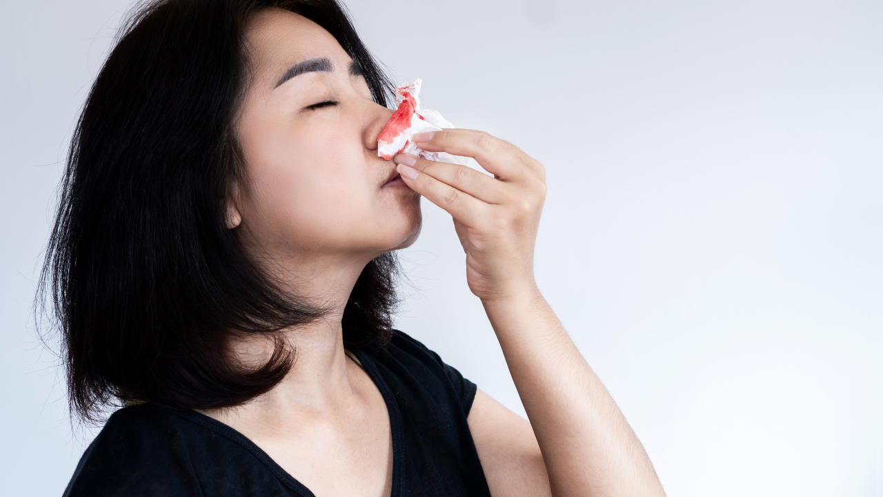 Ung thư máu giai đoạn đầu gây chảy máu cam bất thường