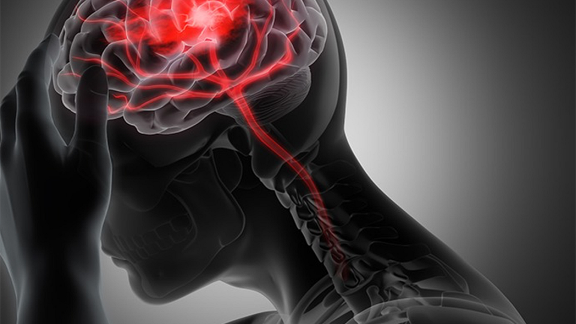 Bệnh nhồi máu não sống được bao lâu? Thời gian sống của bệnh nhân phụ thuộc vào sự kịp thời trong cấp cứu