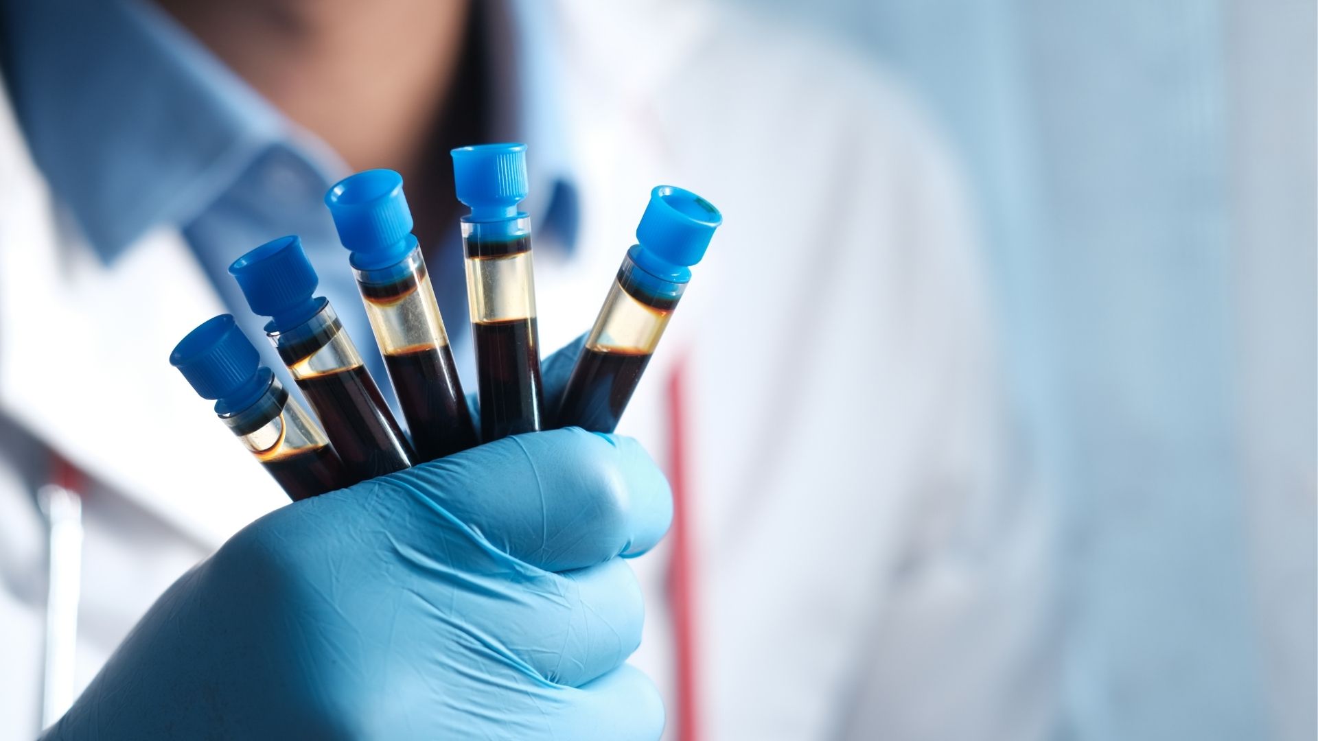 Người bị bệnh tự miễn có nguy cơ mắc bệnh pemphigus