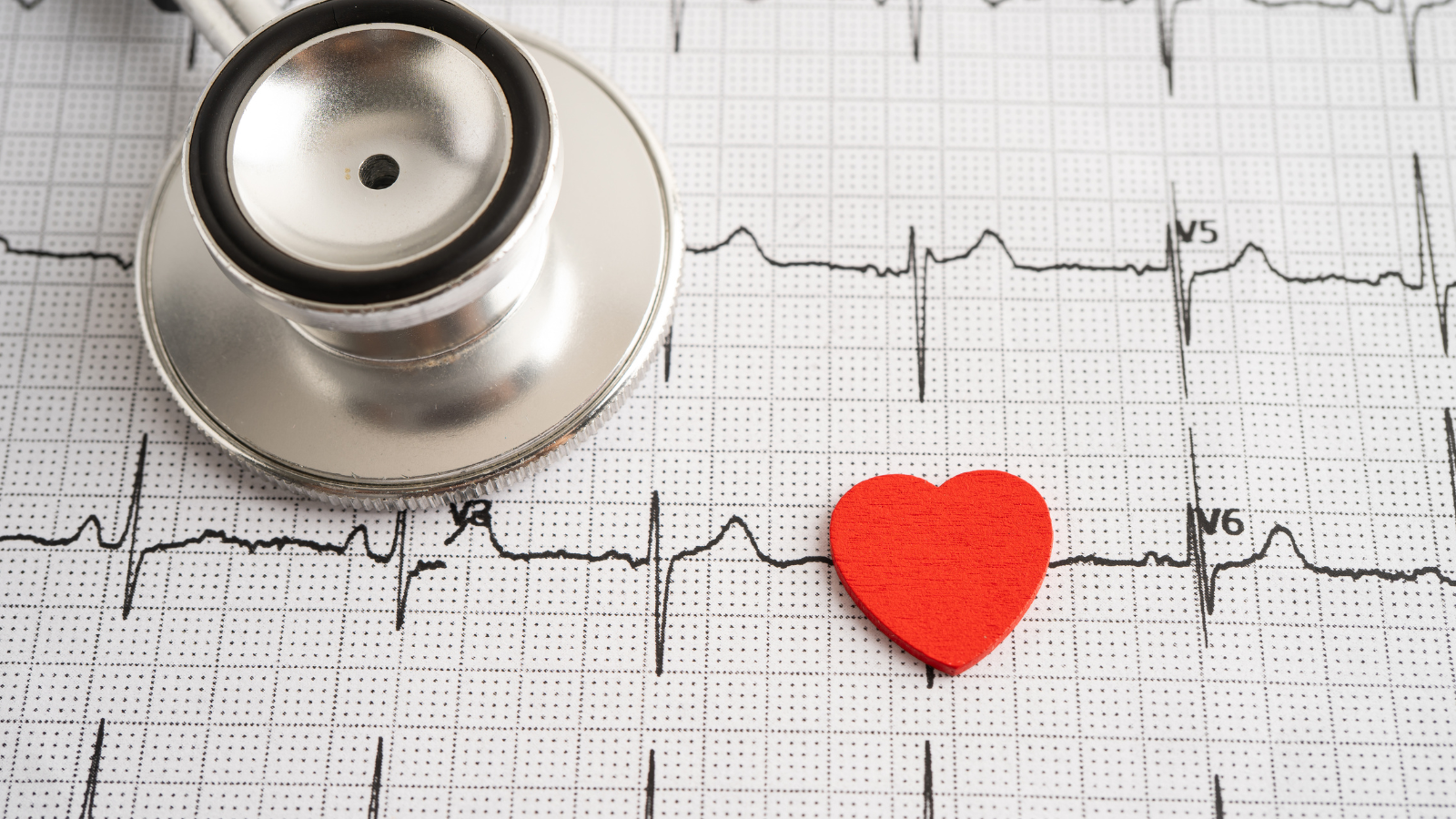 Rối loạn nhịp tim có nguy hiểm không?