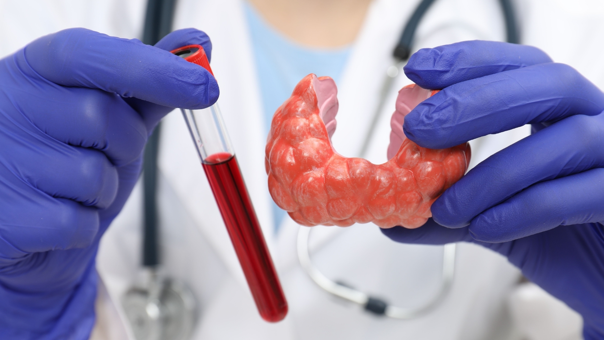 Việc kiểm tra định kỳ nồng độ TSH và T4 tự do giúp bác sĩ đánh giá hiệu quả điều trị và điều chỉnh liều thuốc kịp thời