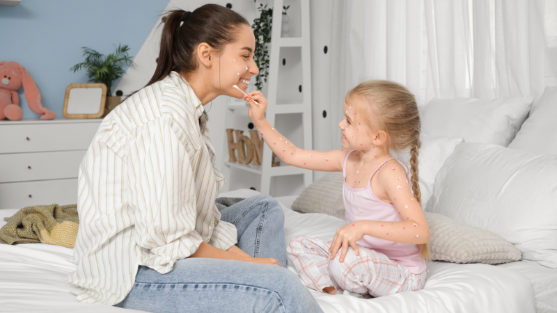 Tiêm phòng và chăm sóc đúng cách giúp phòng ngừa thủy đậu ở trẻ nhỏ