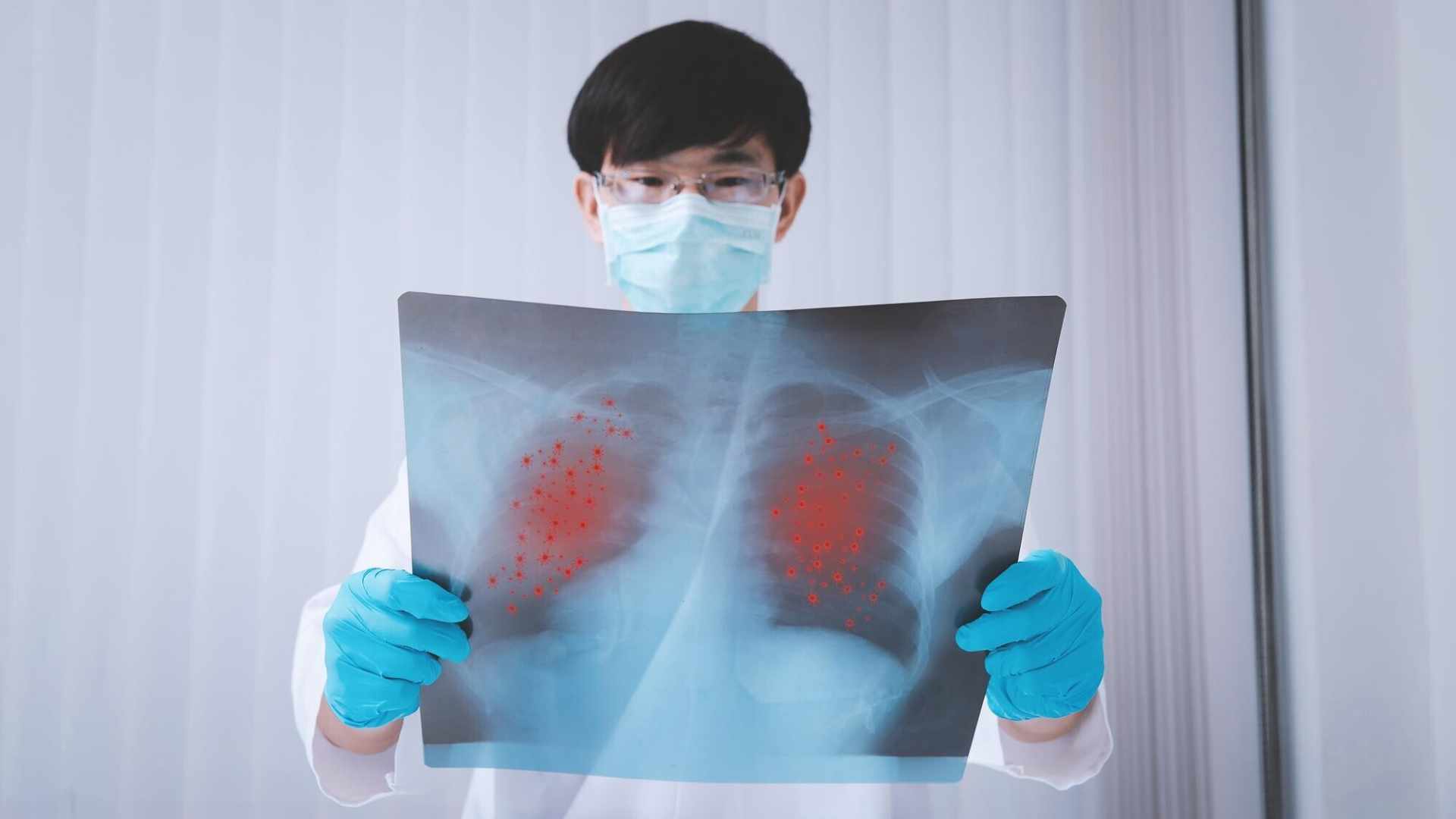 Bệnh ung thư phổi di căn có chữa được không? 2