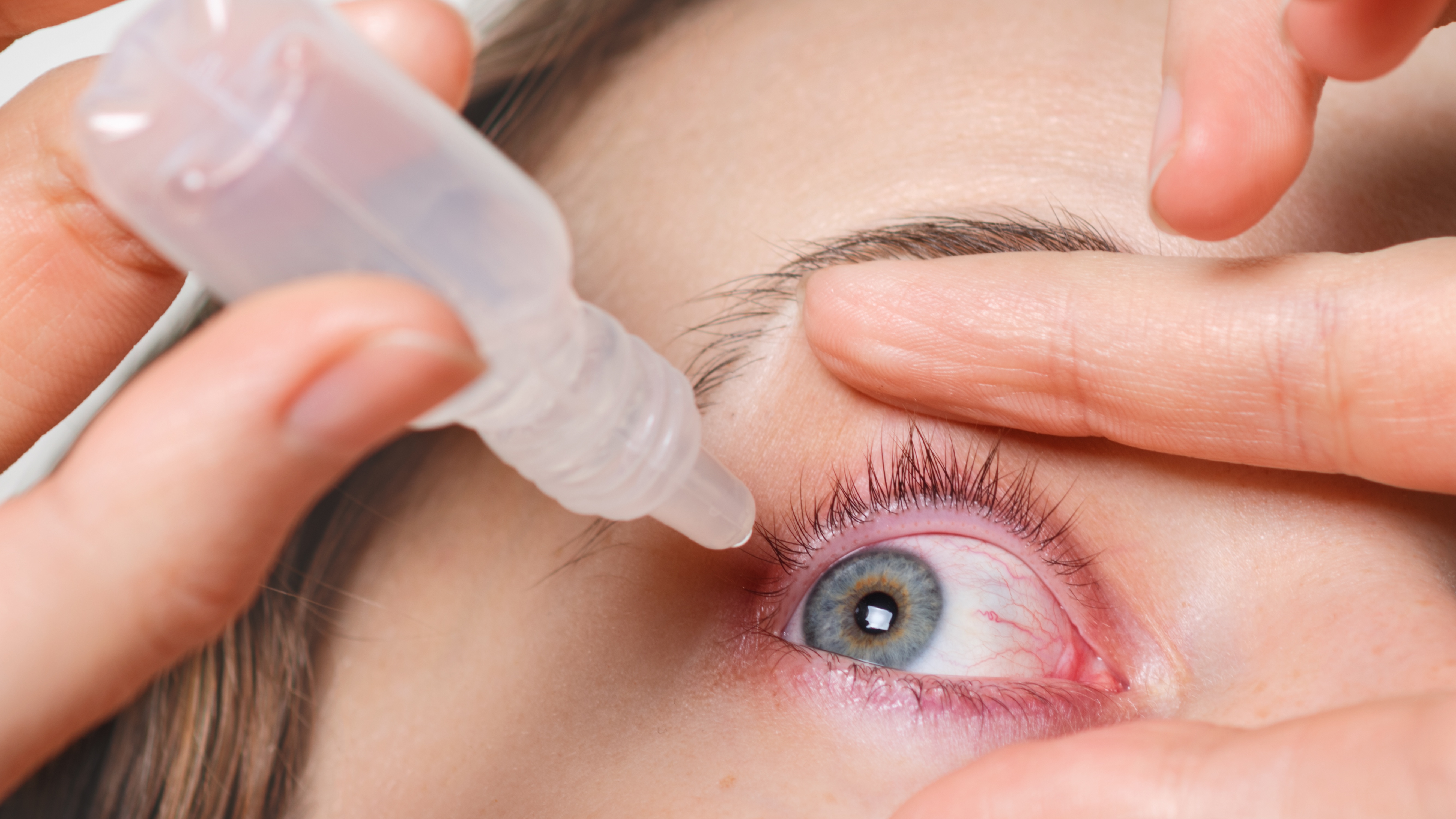 Giữ vệ sinh mắt sạch sẽ là rất quan trọng