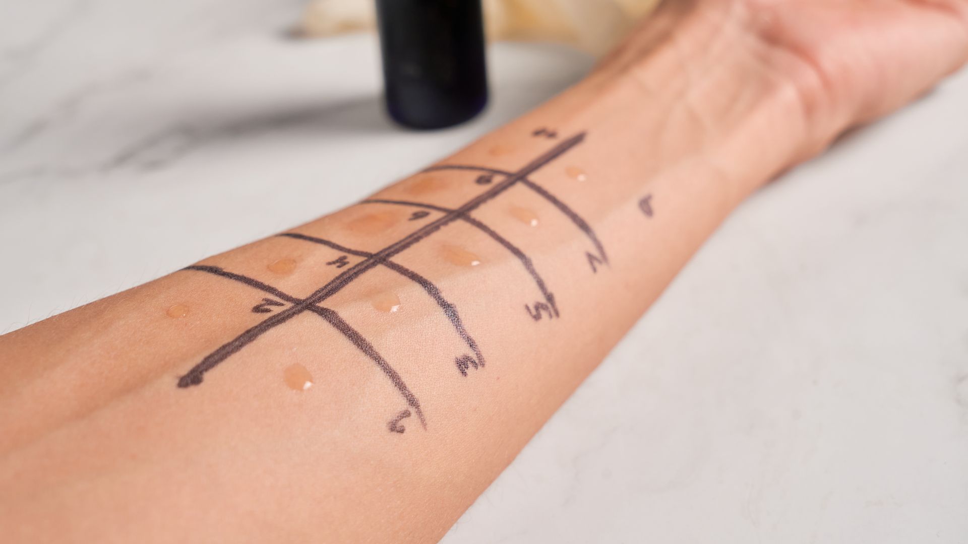 Test lẩy da cho thấy phản ứng của cơ thể với các dị nguyên