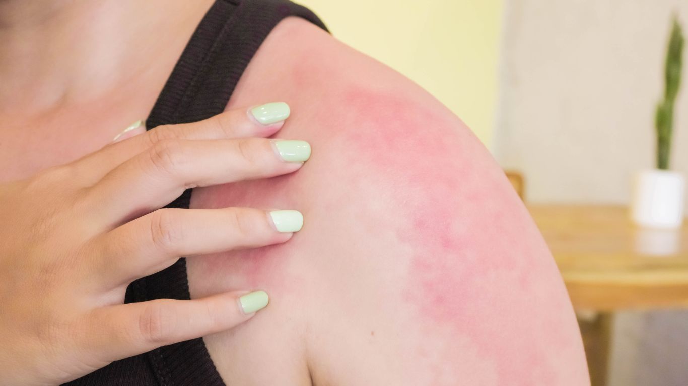 bi-cam-co-tiem-uon-van-duoc-khong 2