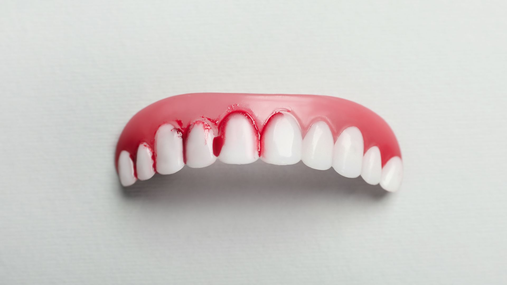 Thiếu vitamin và khoáng chất là lời giải cho thắc mắc bị chảy máu chân răng là thiếu chất gì