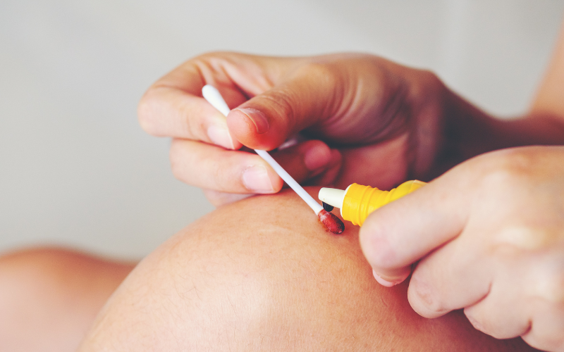 bi-cho-can-khong-chich-ngua-co-sao-khong-2