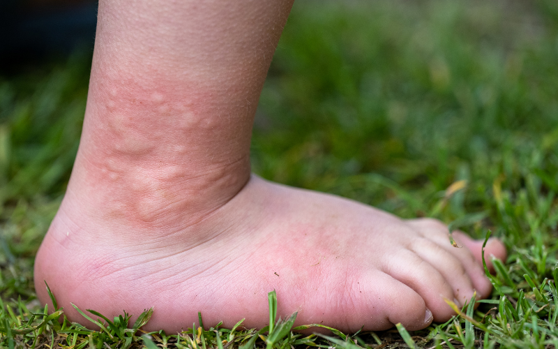 bi-chuot-can-co-nen-tiem-phong-dai-khong-2