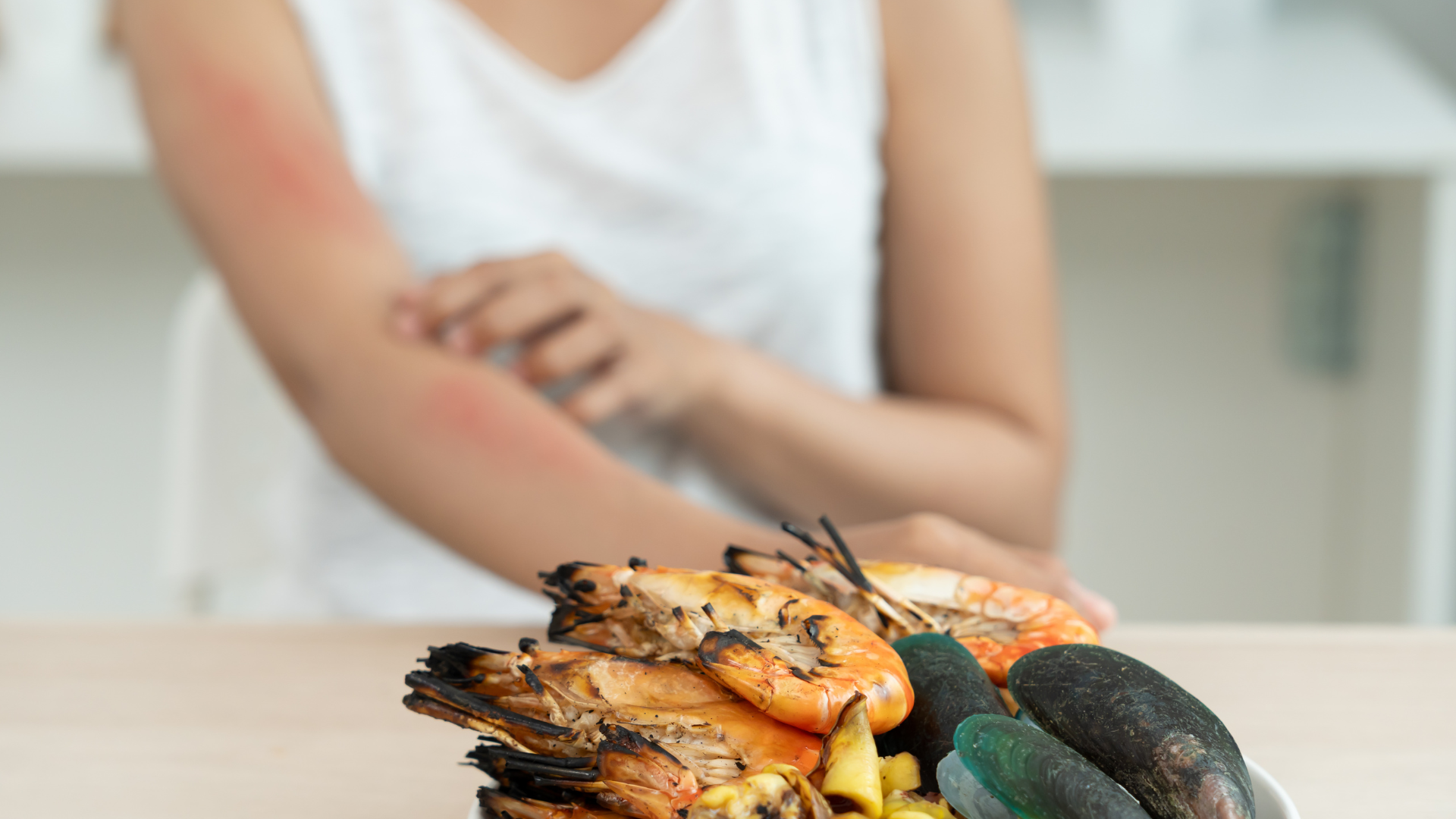 Một số thực phẩm có thể kích hoạt phản ứng miễn dịch, dẫn đến nổi mẩn đỏ trên da