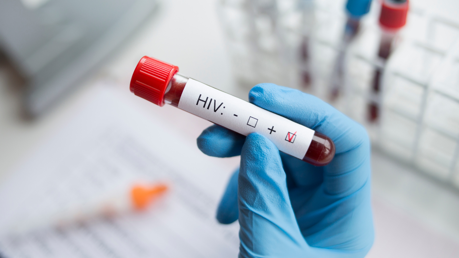 Người nhiễm HIV thường dễ mắc các thể ghẻ nặng