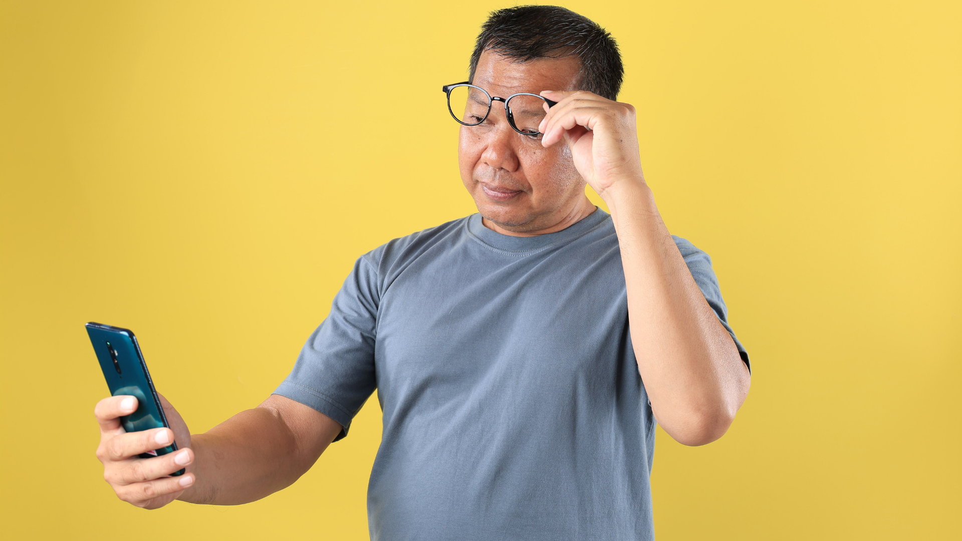 Mắt bị loạn thị có tự khỏi không? Loạn thị liên quan đến cấu trúc giải phẫu của mắt nên không thể tự hồi phục theo thời gian