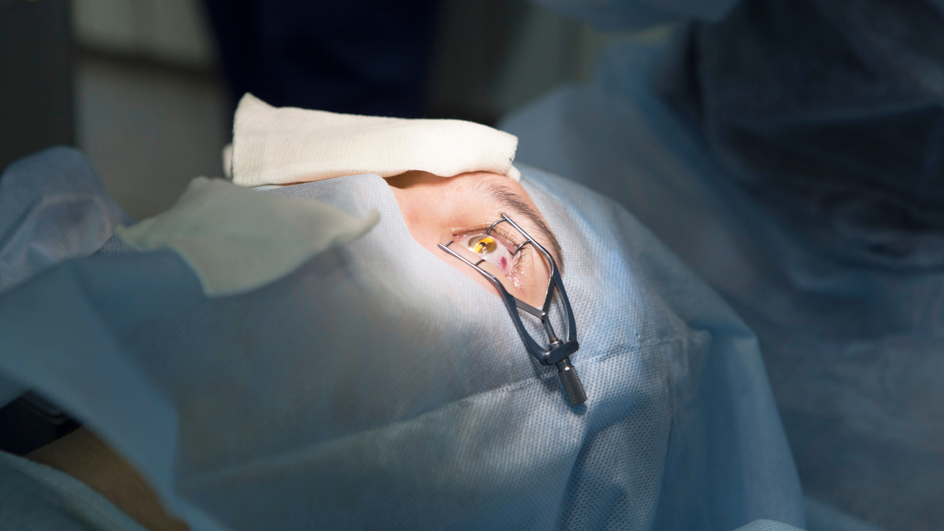 Phẫu thuật khúc xạ là phương pháp điều trị lâu dài cho người loạn thị