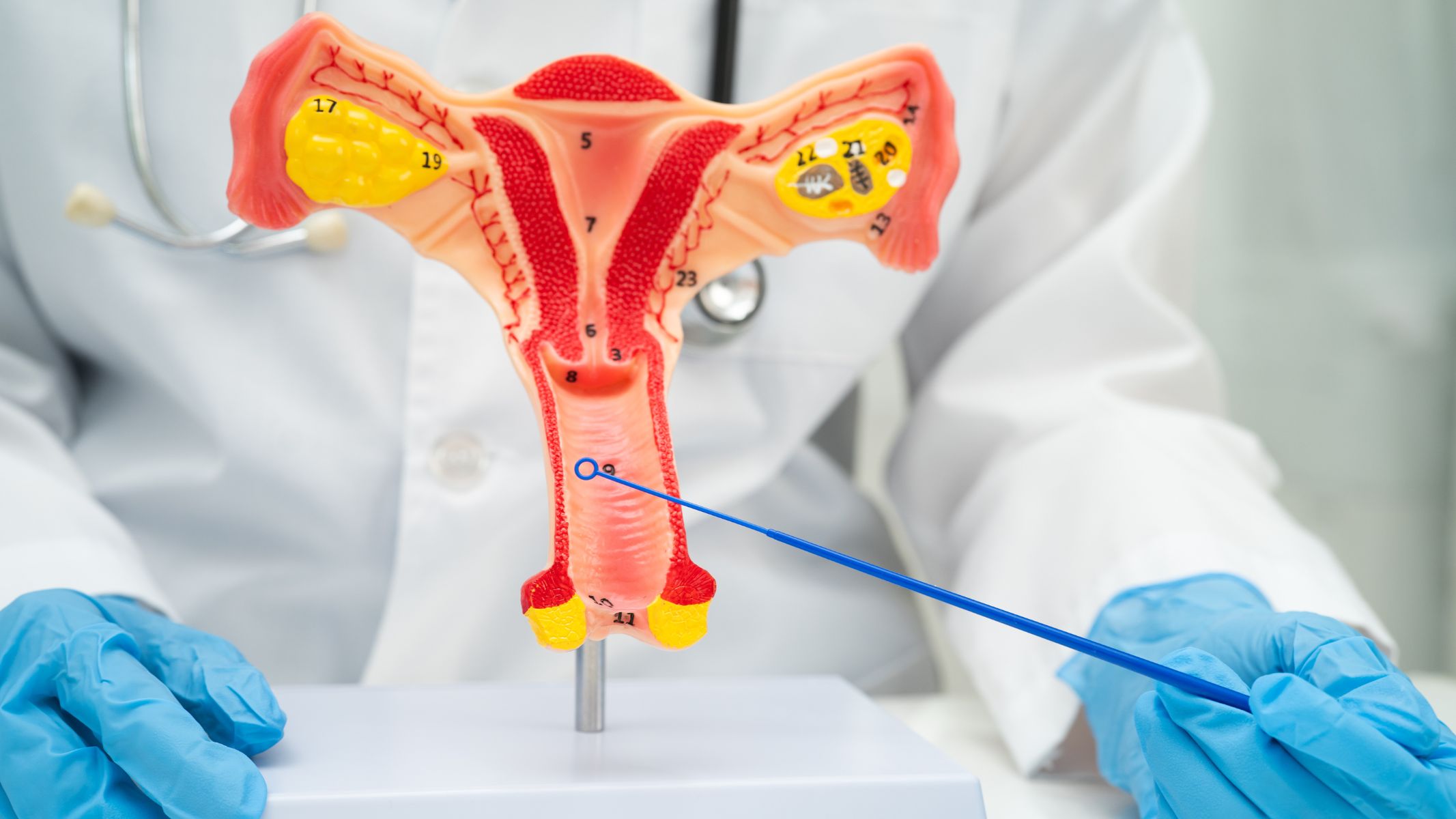 Ngứa vùng kín dữ dội là triệu chứng phổ biến nhất khi bị nhiễm nấm Candida