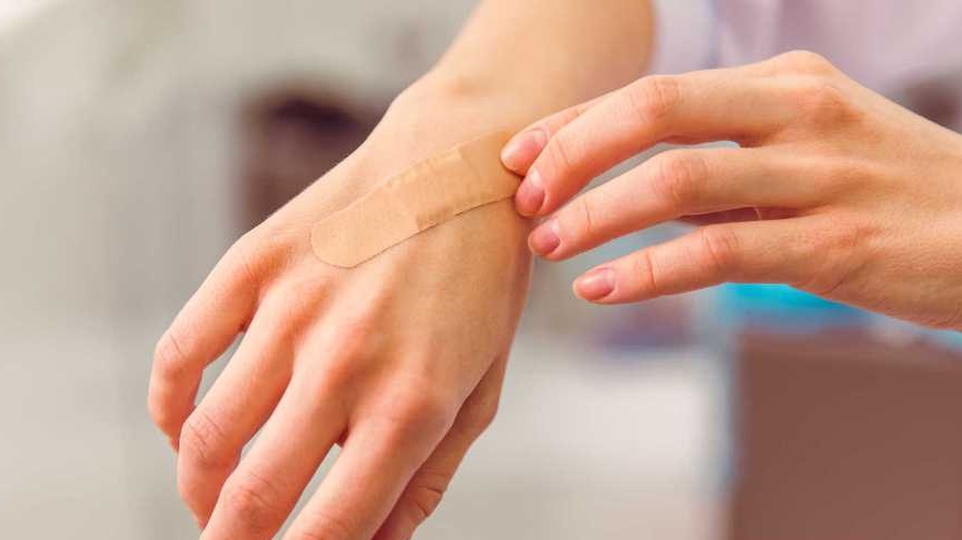 Giữ vùng da bị cắn luôn sạch sẽ