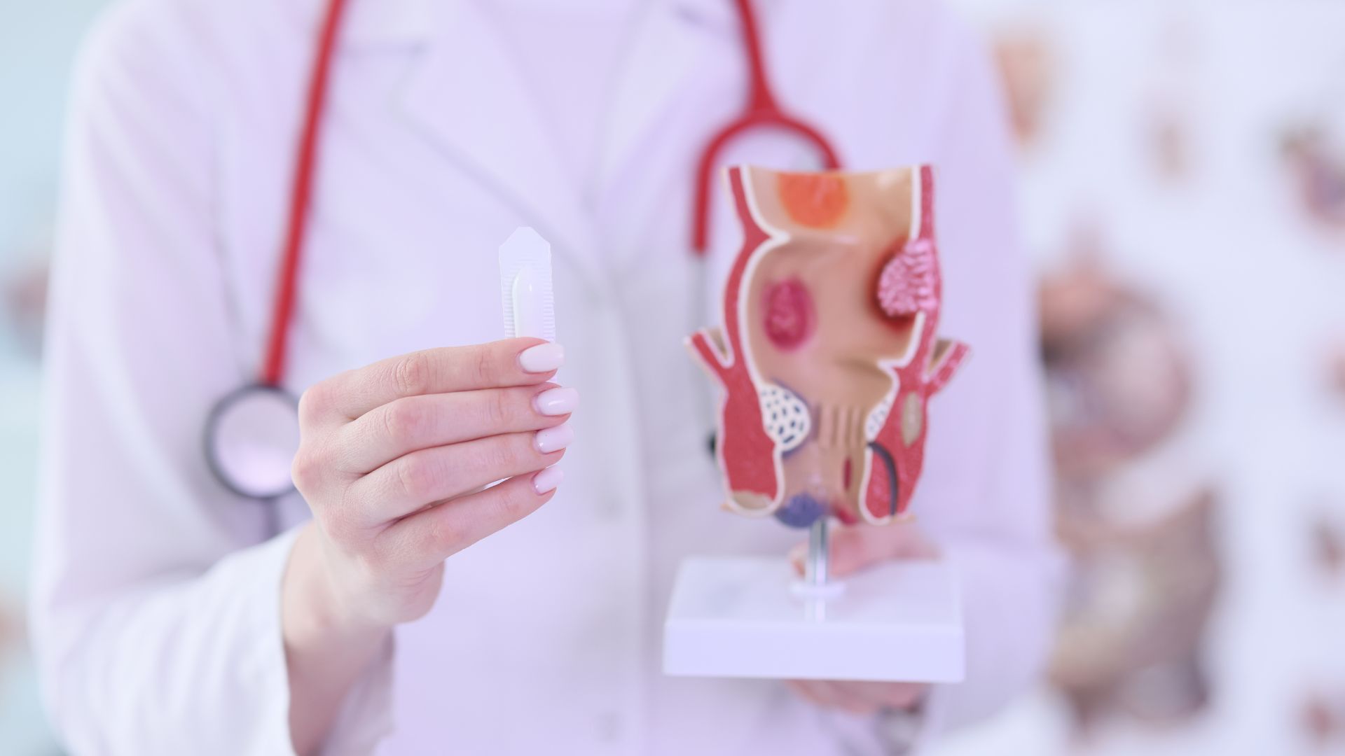 Bị polyp hậu môn có nguy hiểm không? Điều trị polyp hậu môn như thế nào? 2