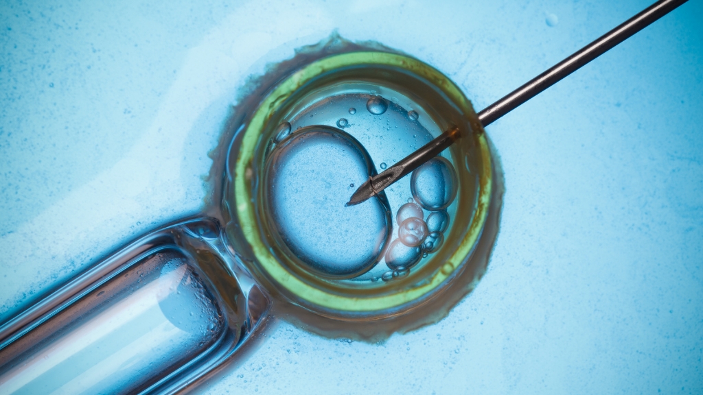 Vô sinh do quai bị vẫn có thể được khắc phục bằng các kỹ thuật hỗ trợ sinh sản IVF hoặc ICSI