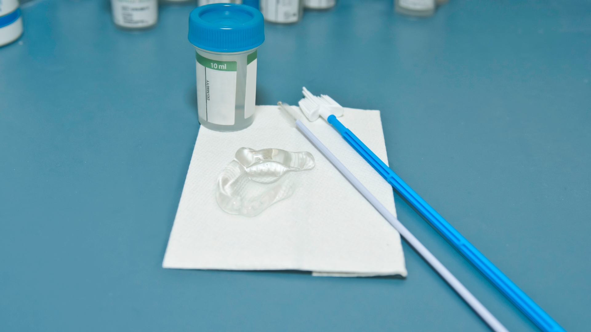 bi-sui-mao-ga-nhung-xet-nghiem-HPV-am-tinh 03.jpg