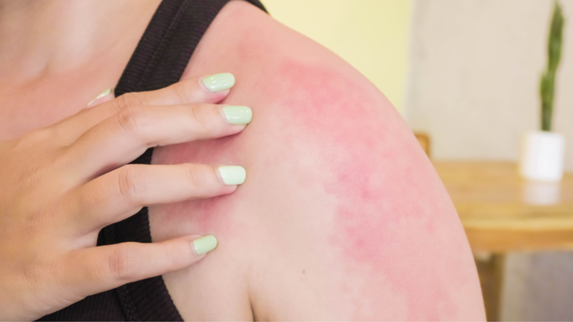 bi-sung-mat-la-gi-nguyen-nhan-va-bien-phap-khac-phuc (3).png