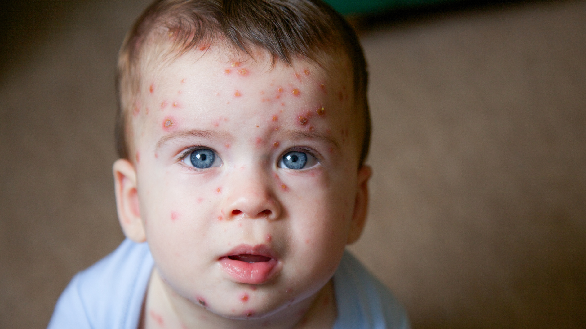 bi-thuy-dau-roi-co-bi-lai-khong-bien-phap-phong-tai-phat-thuy-dau (2).png