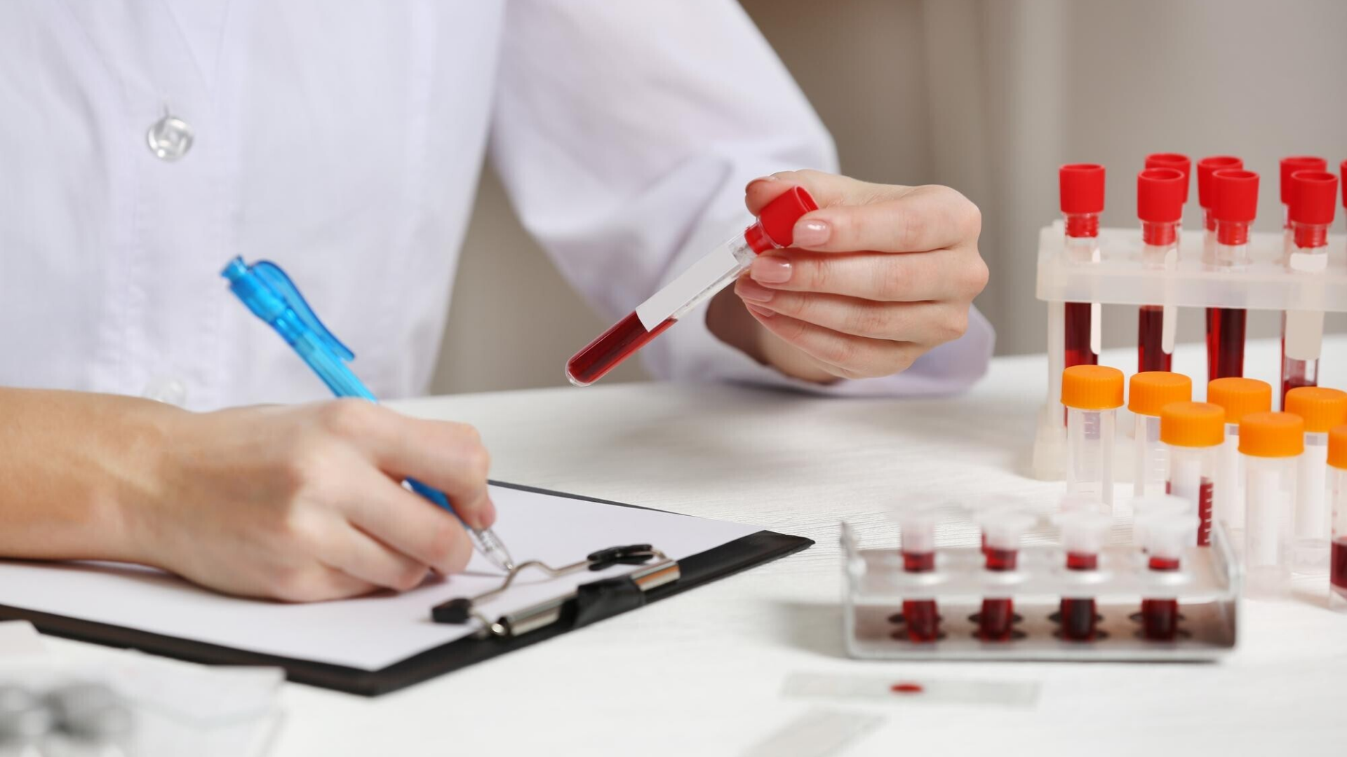 Đa số trường hợp du học chỉ yêu cầu kiểm tra tổng quát như thực hiện một số xét nghiệm máu cơ bản