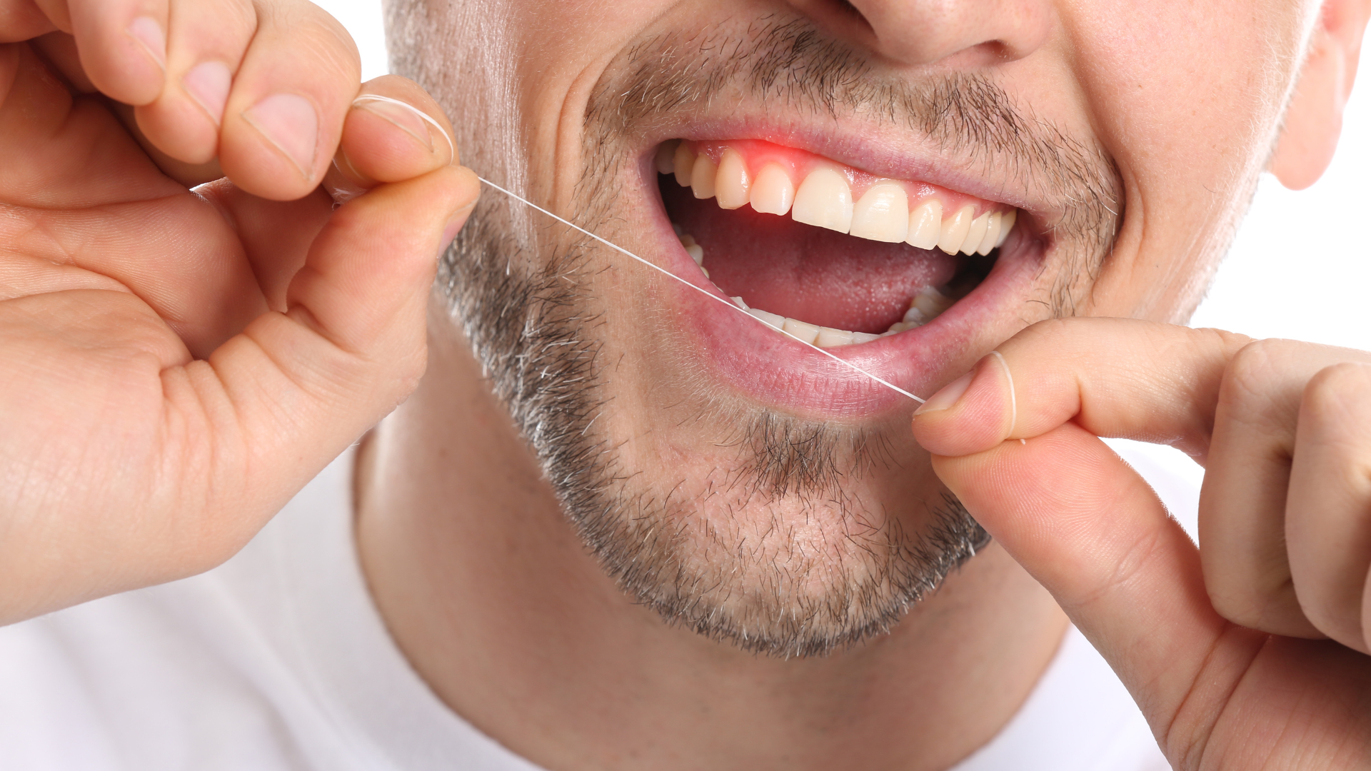 Chăm sóc răng miệng cẩn thận để phòng ngừa tình trạng viêm nướu