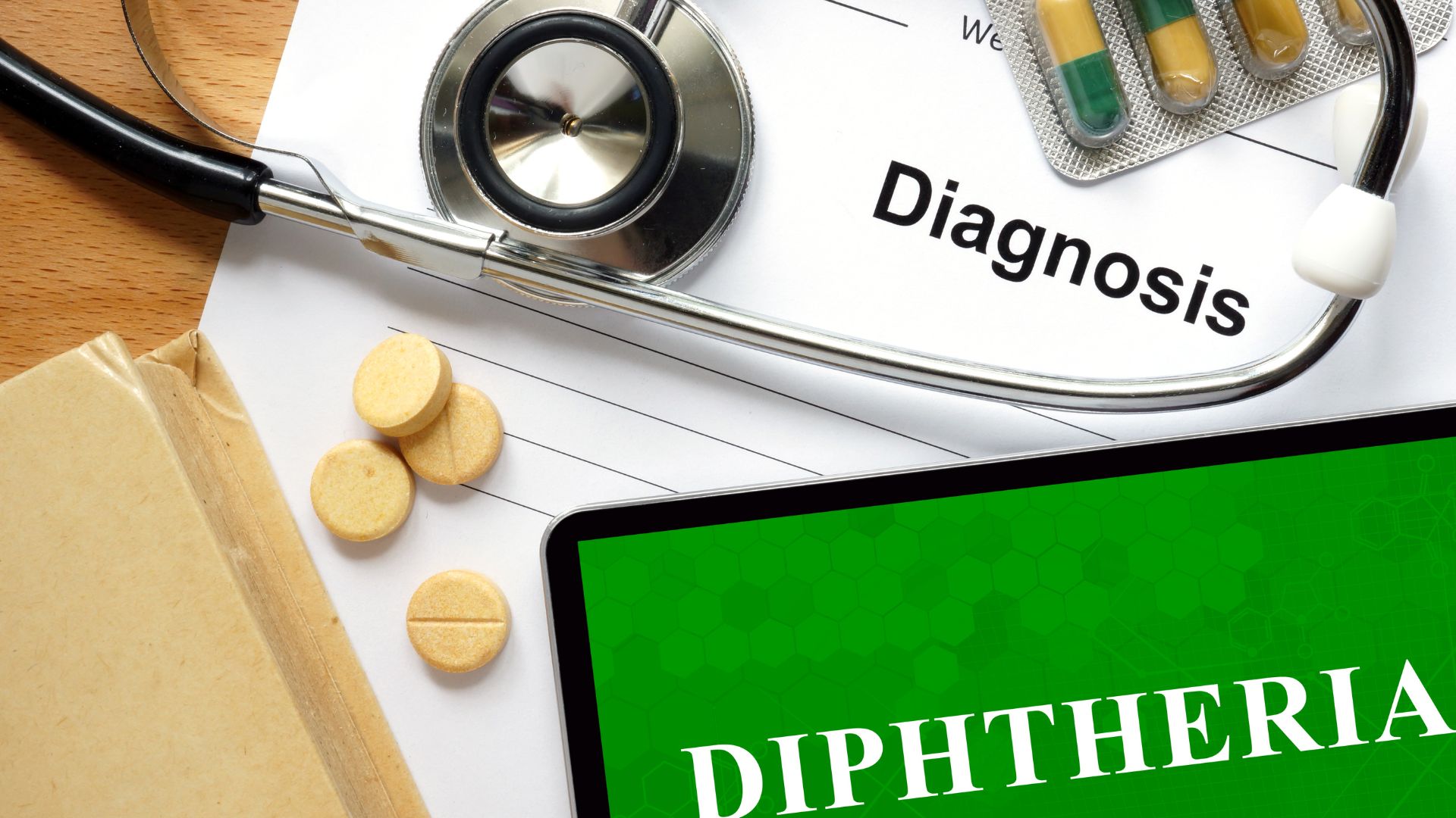 Biến chứng bệnh bạch hầu có thể xuất hiện ngay trong giai đoạn đầu