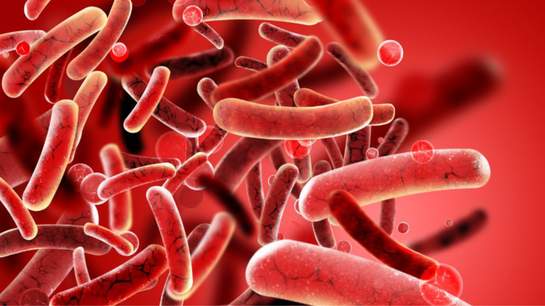 bien-chung-cua-viem-tinh-hoan-ban-nen-biet (2).png