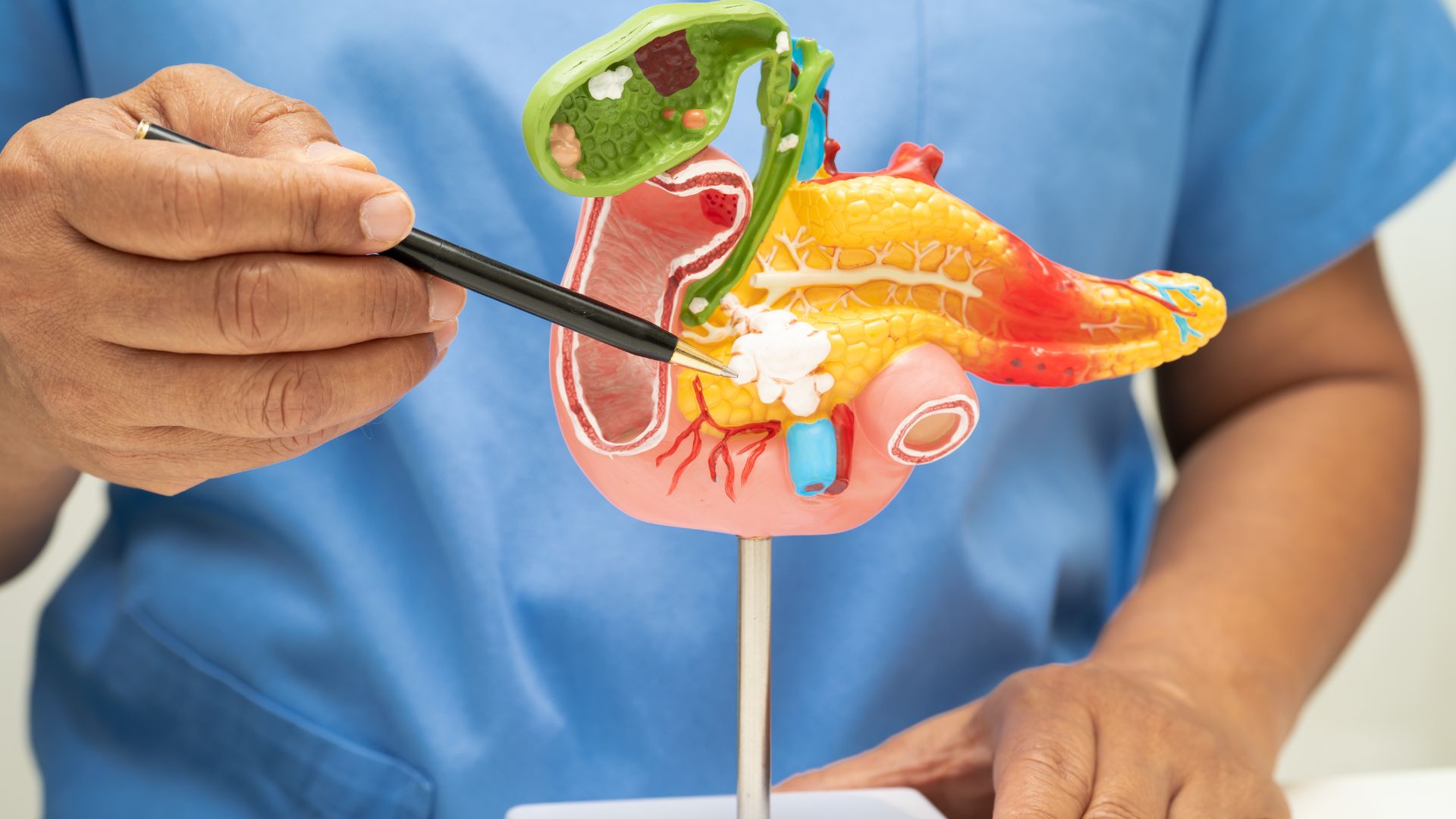 Biến chứng viêm gan A: Những nguy cơ tiềm ẩn không thể chủ quan 3