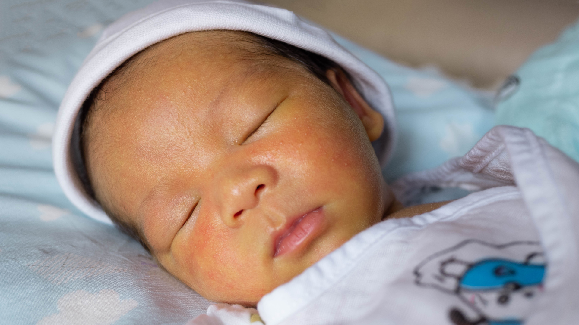 Trẻ sơ sinh thường vặn mình có thể xuất phát từ bệnh lý vàng da sơ sinh kéo dài