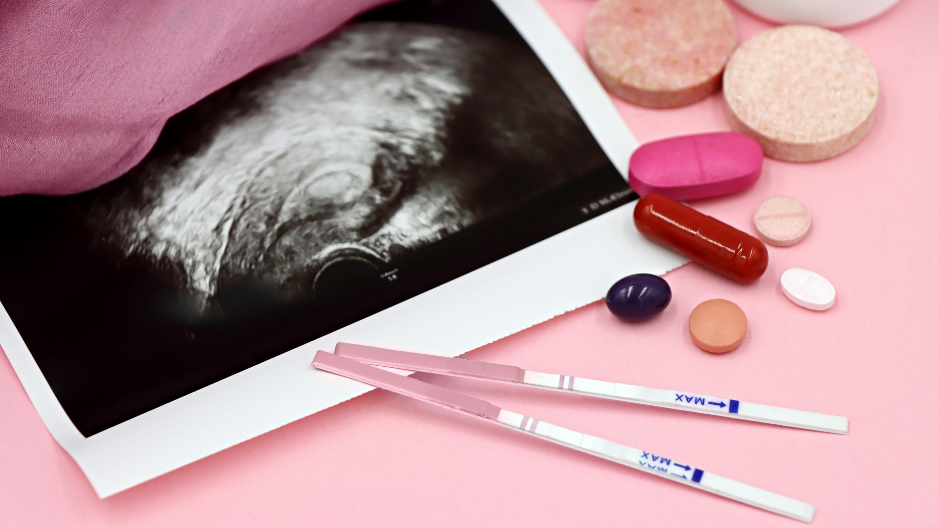 Thay đổi nội tiết tố là nguyên nhân khiến bà bầu bị ốm nghén