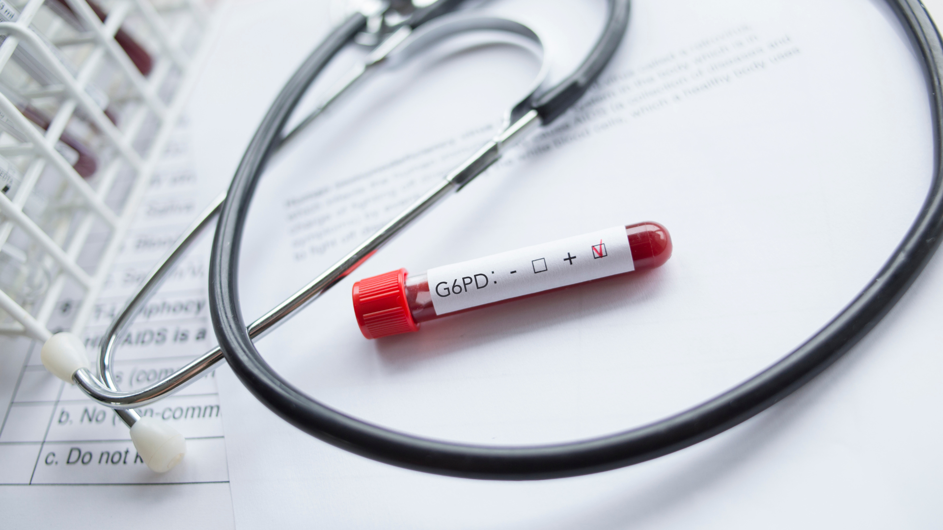 Chỉ số G6PD bao nhiêu là bình thường?