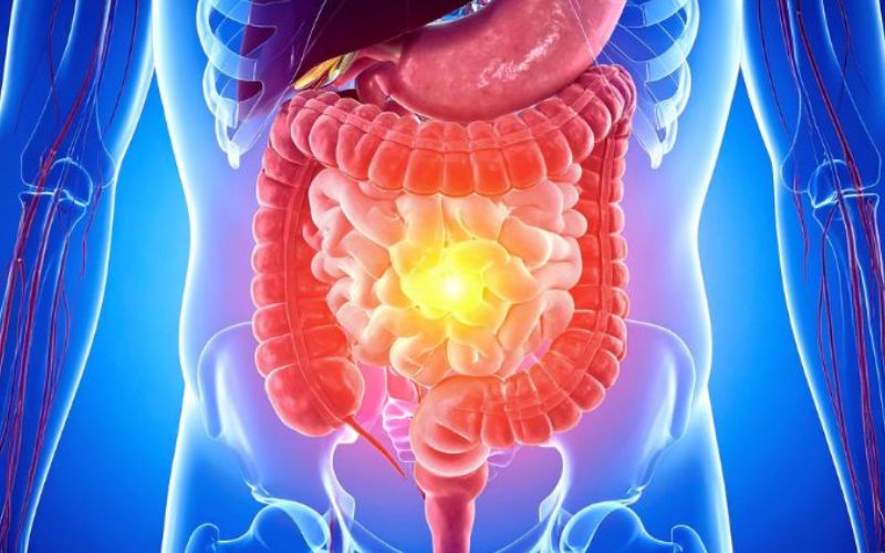 Tiêu chảy sốt ớn lạnh là biểu hiện thường gặp ở người bị rối loạn tiêu hóa, viêm đường ruột