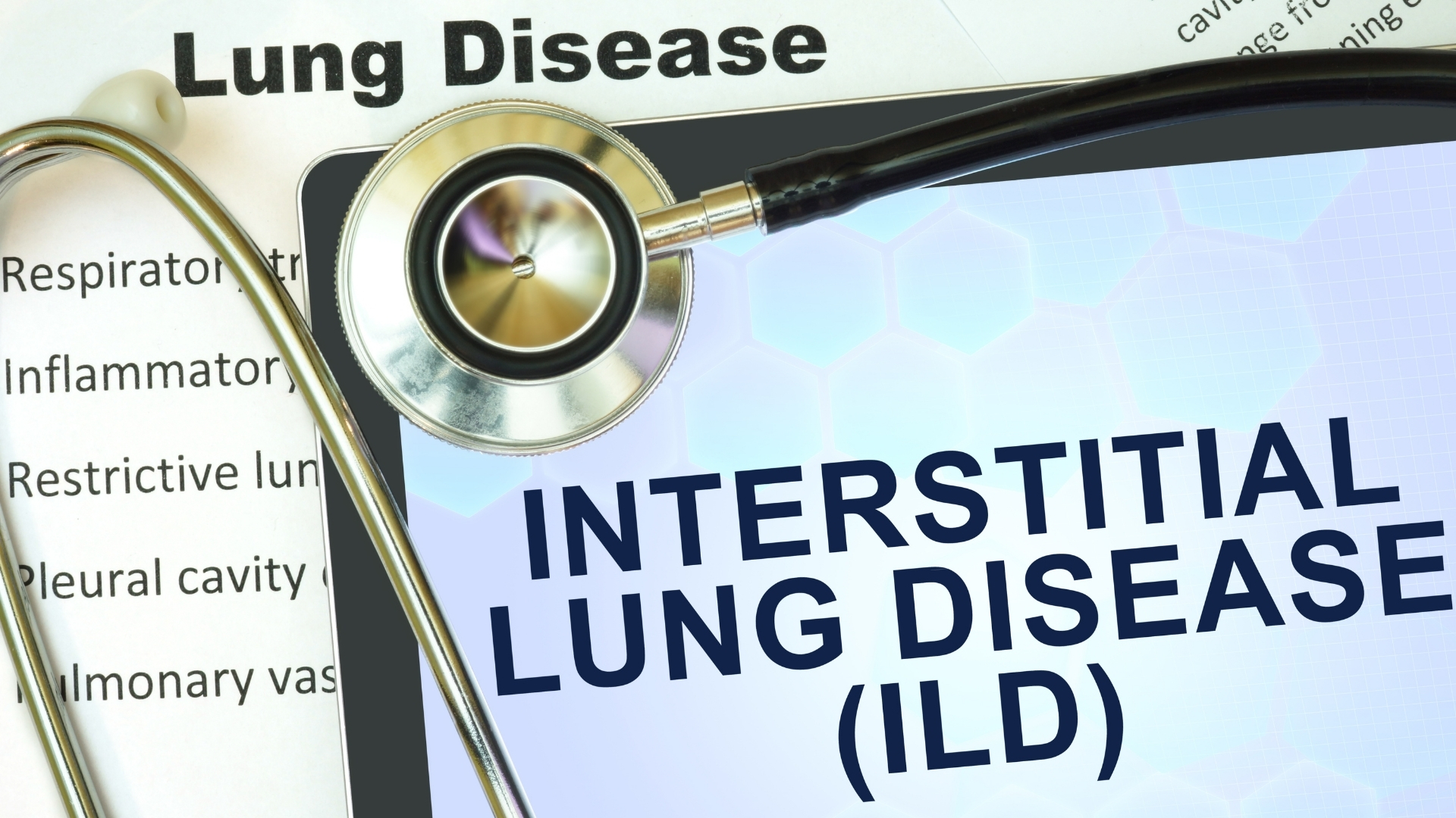 Bệnh phổi mô kẽ gây tổn thương tế bào biểu mô phế nang, ảnh hưởng đến quá trình trao đổi khí