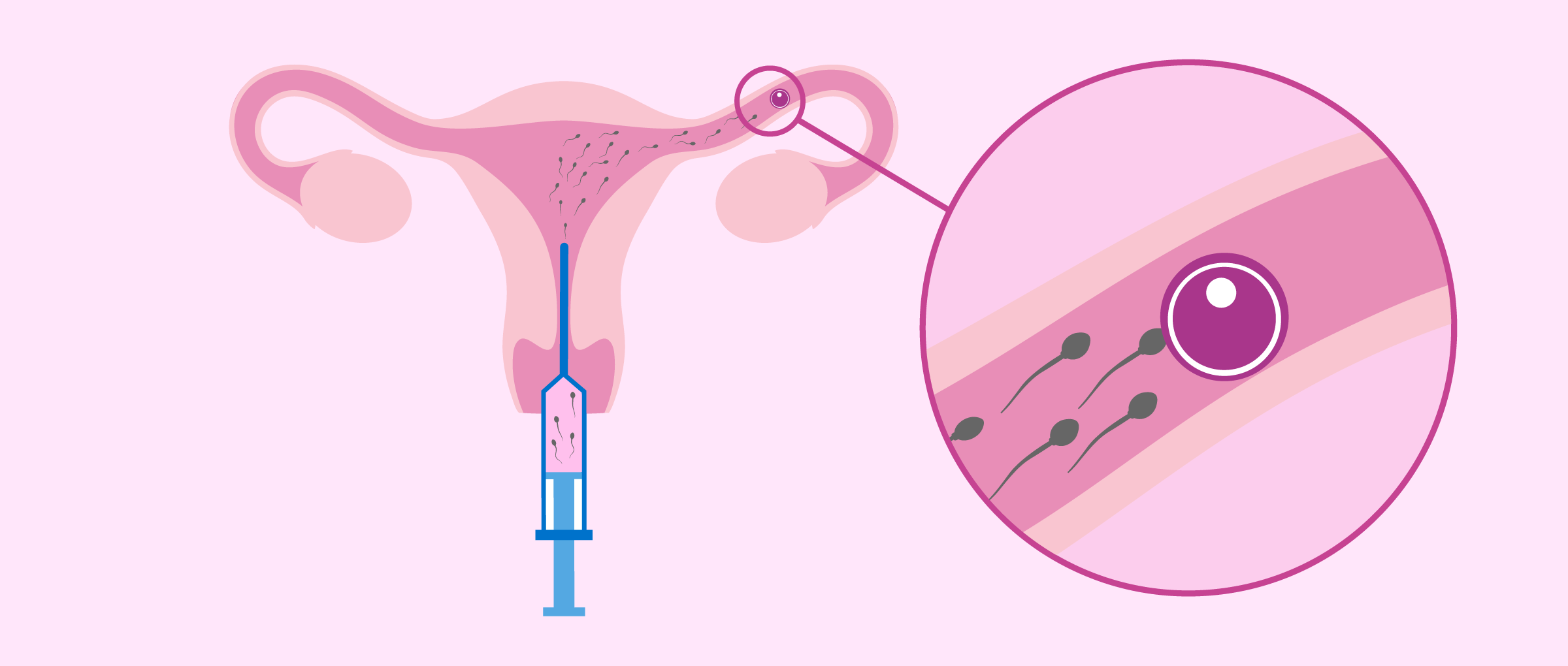 bom-iui-chi-phi-bao-nhieu-4