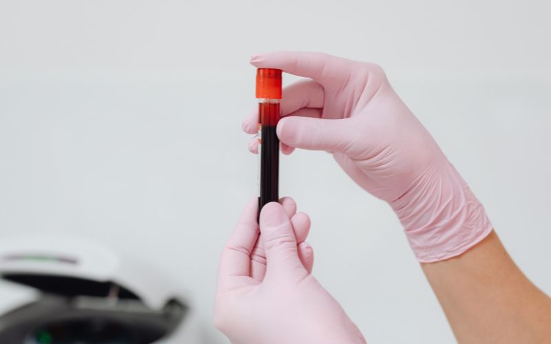 Trong trường hợp sau 10 ngày thử thai mà que vẫn chỉ hiện 1 vạch, bạn nên cân nhắc làm xét nghiệm máu beta hCG