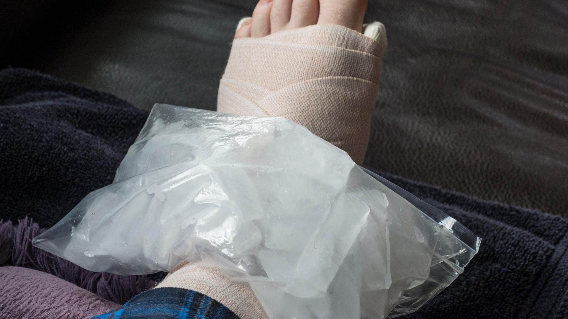 Điều trị bong gân mắt cá chân cần kết hợp nghỉ ngơi và phục hồi vận động