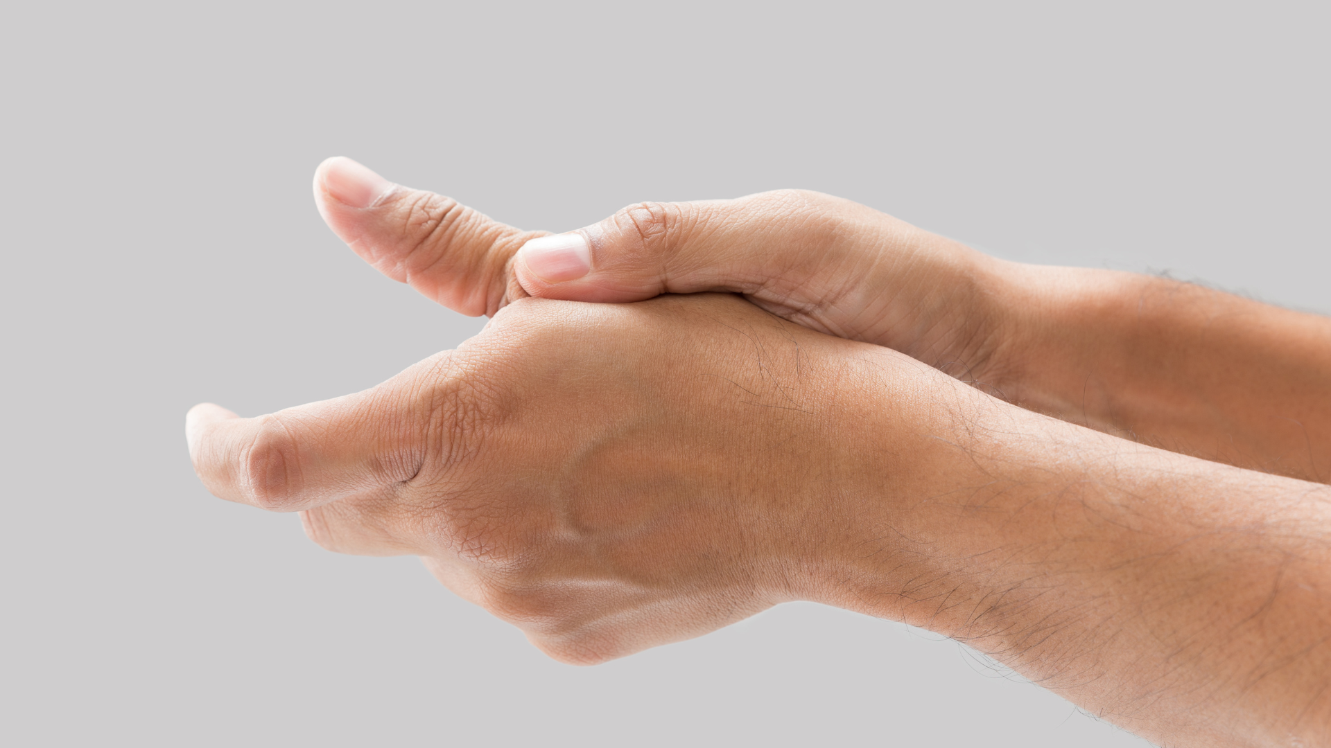 Bong gân ngón tay cái là tình trạng dây chằng quanh khớp ngón cái bị kéo giãn hoặc rách