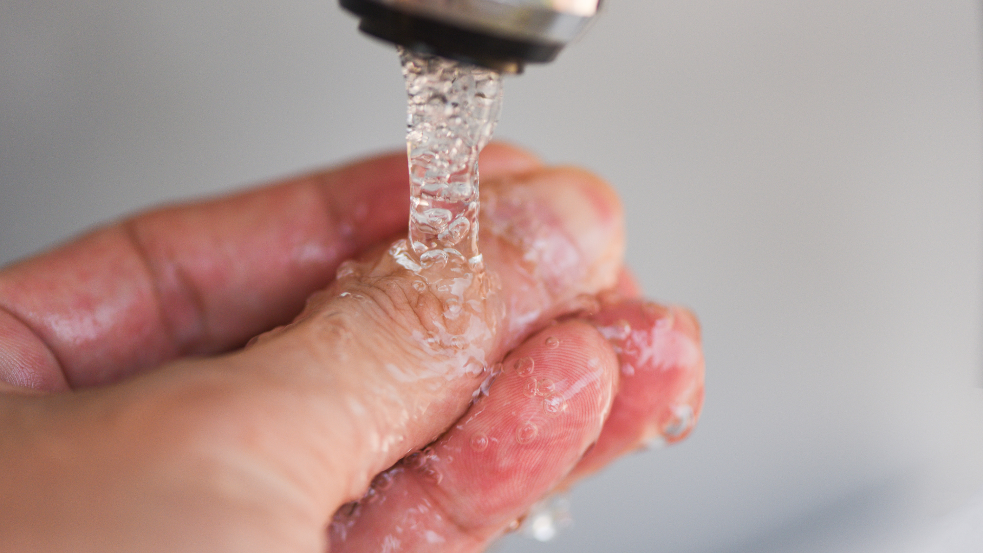 Sơ cứu bỏng nước sôi đúng cách trong 20 phút đầu