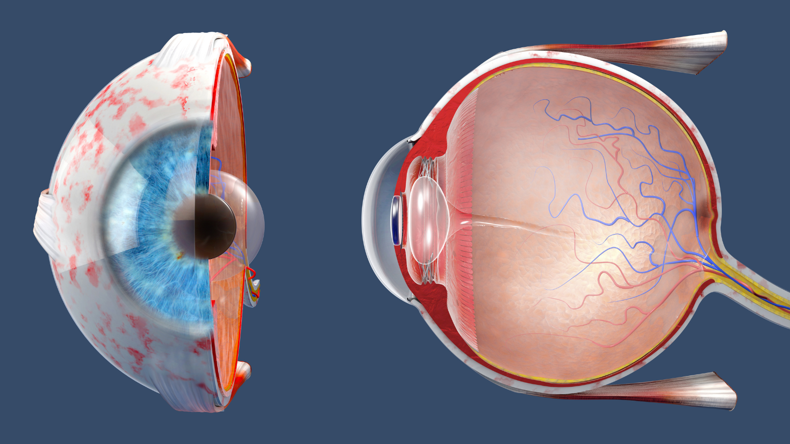 Mục tiêu của điều trị bong võng mạc là cố định võng mạc về vị trí bạn đầu