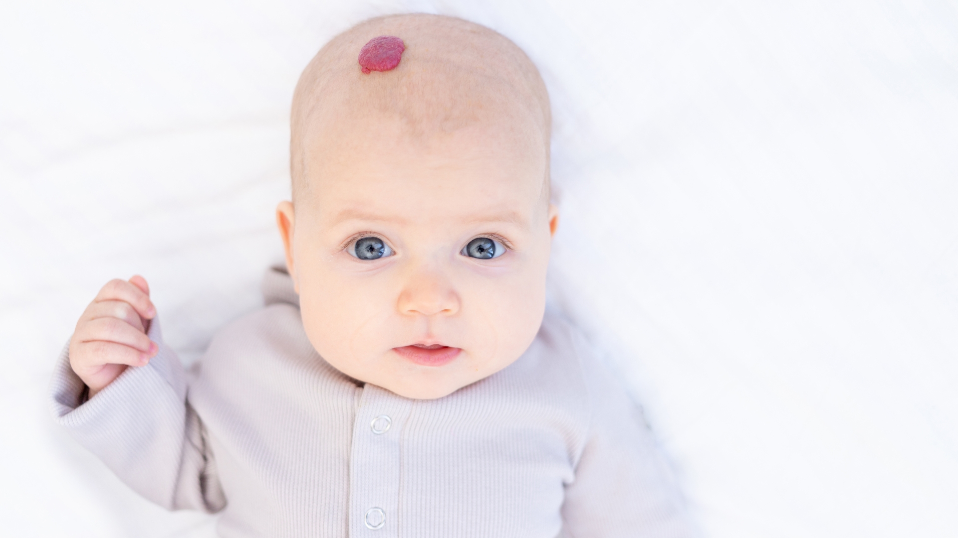 Nếu vết bớt có kích thước tăng nhanh bất thường hoặc bị loét, chảy dịch cha mẹ cần chú ý cho trẻ thăm khám kịp thời