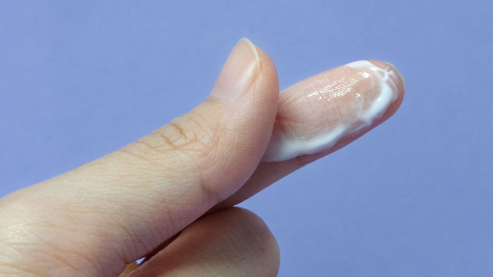 Bựa sinh dục là lớp chất màu trắng ngà hoặc hơi vàng nhạt, thường tích tụ ở vùng kín