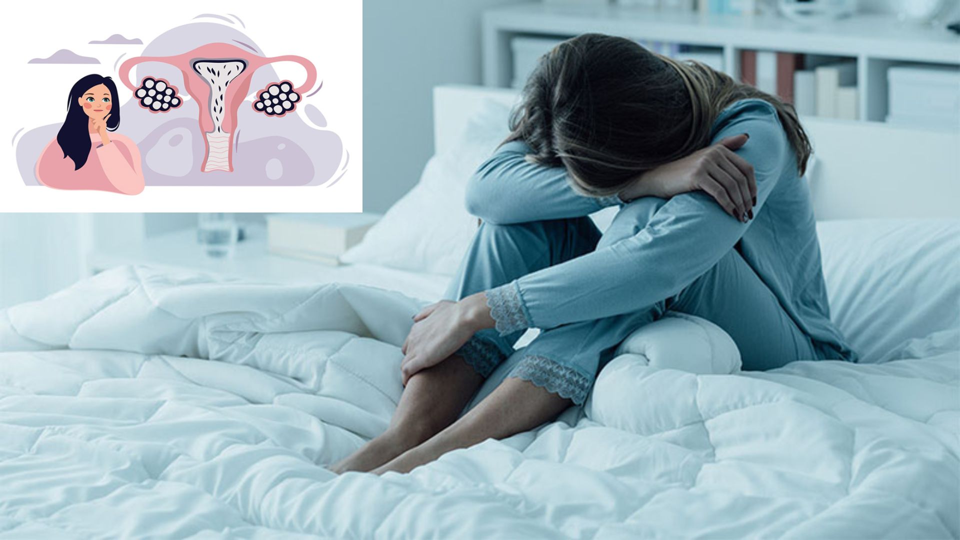 Buồng trứng đa nang có tự khỏi không? Giải đáp từ chuyên gia và hướng điều trị hiệu quả 2