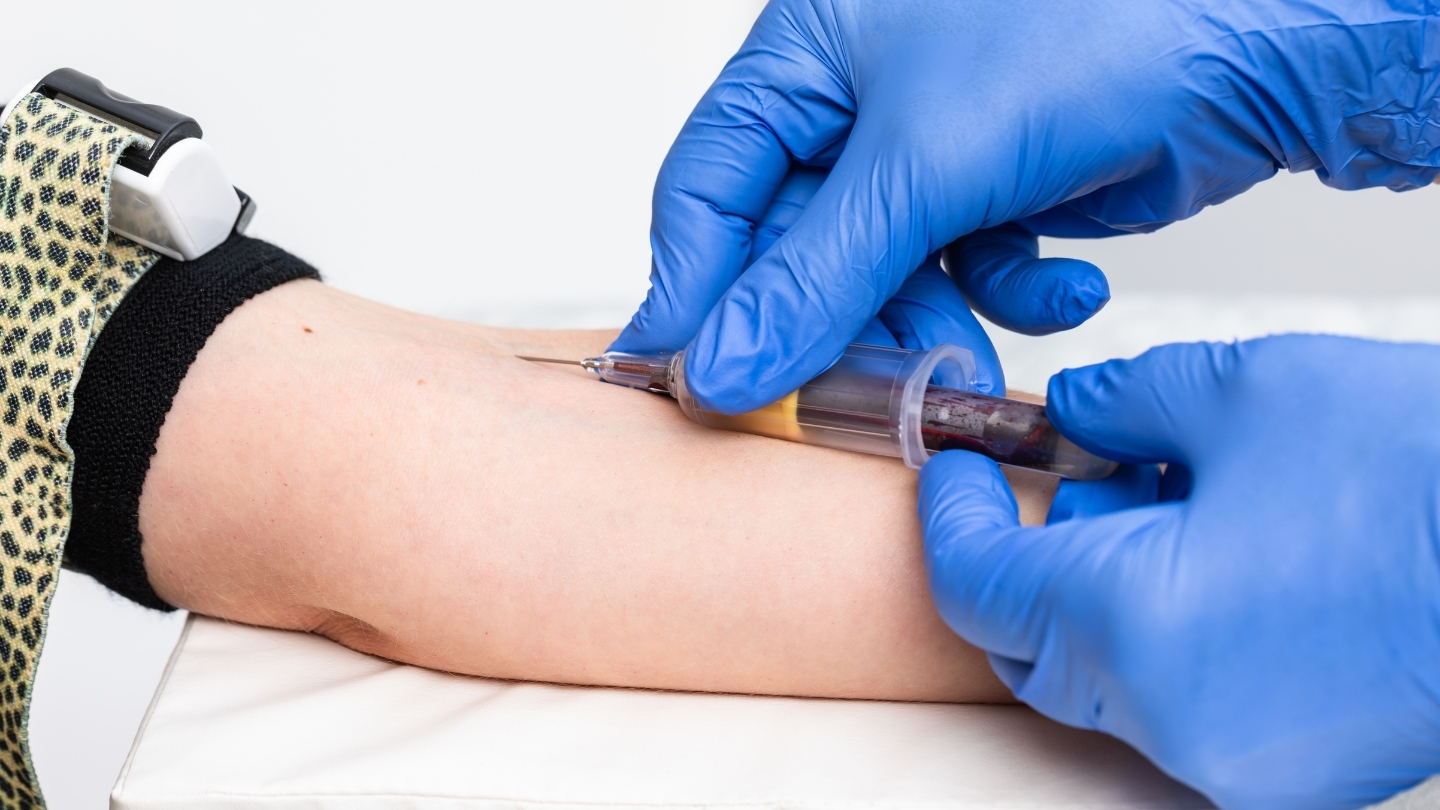 Mẫu máu được lấy từ tĩnh mạch ở cánh tay bằng dụng cụ vô khuẩn và tuân thủ đầy đủ quy trình kiểm soát nhiễm khuẩn
